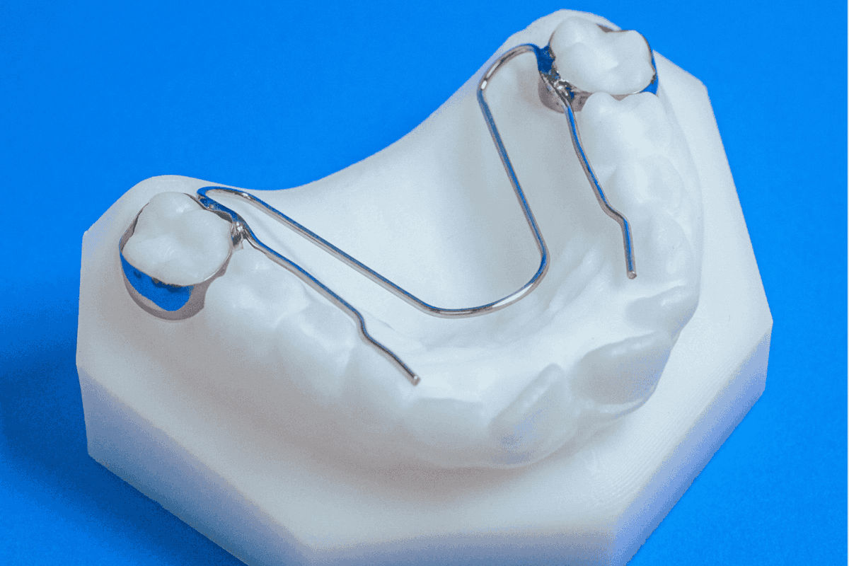 Appareil orthodontique Arc de Nance