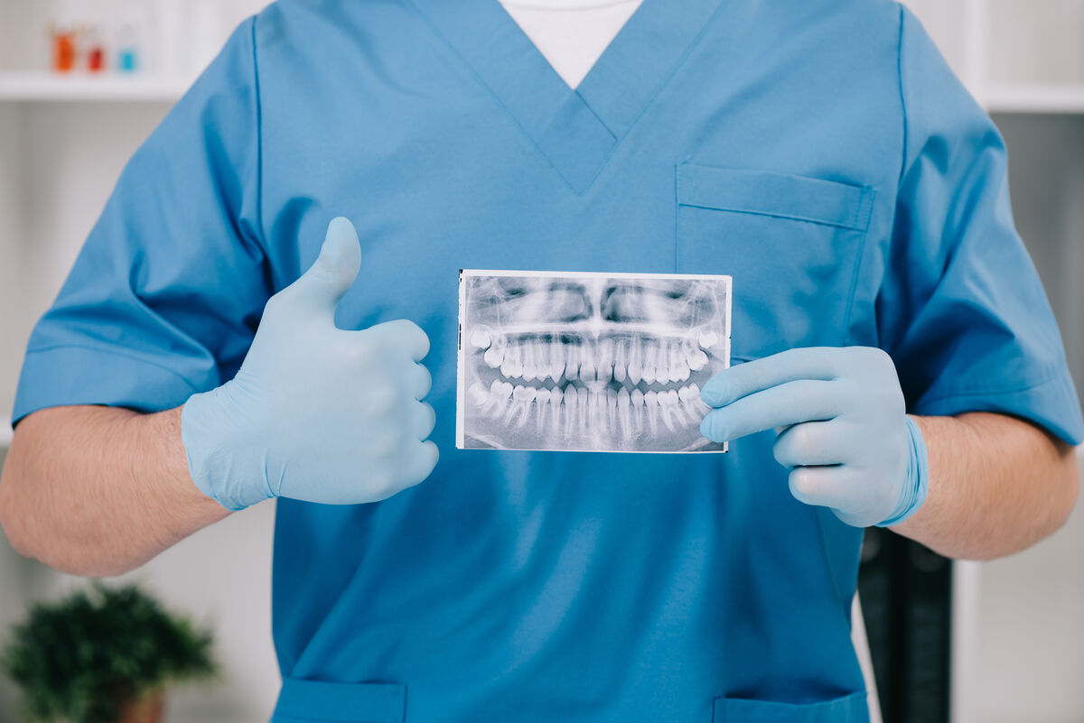 Radiographie panoramique dentaire montrant la position des dents de sagesse