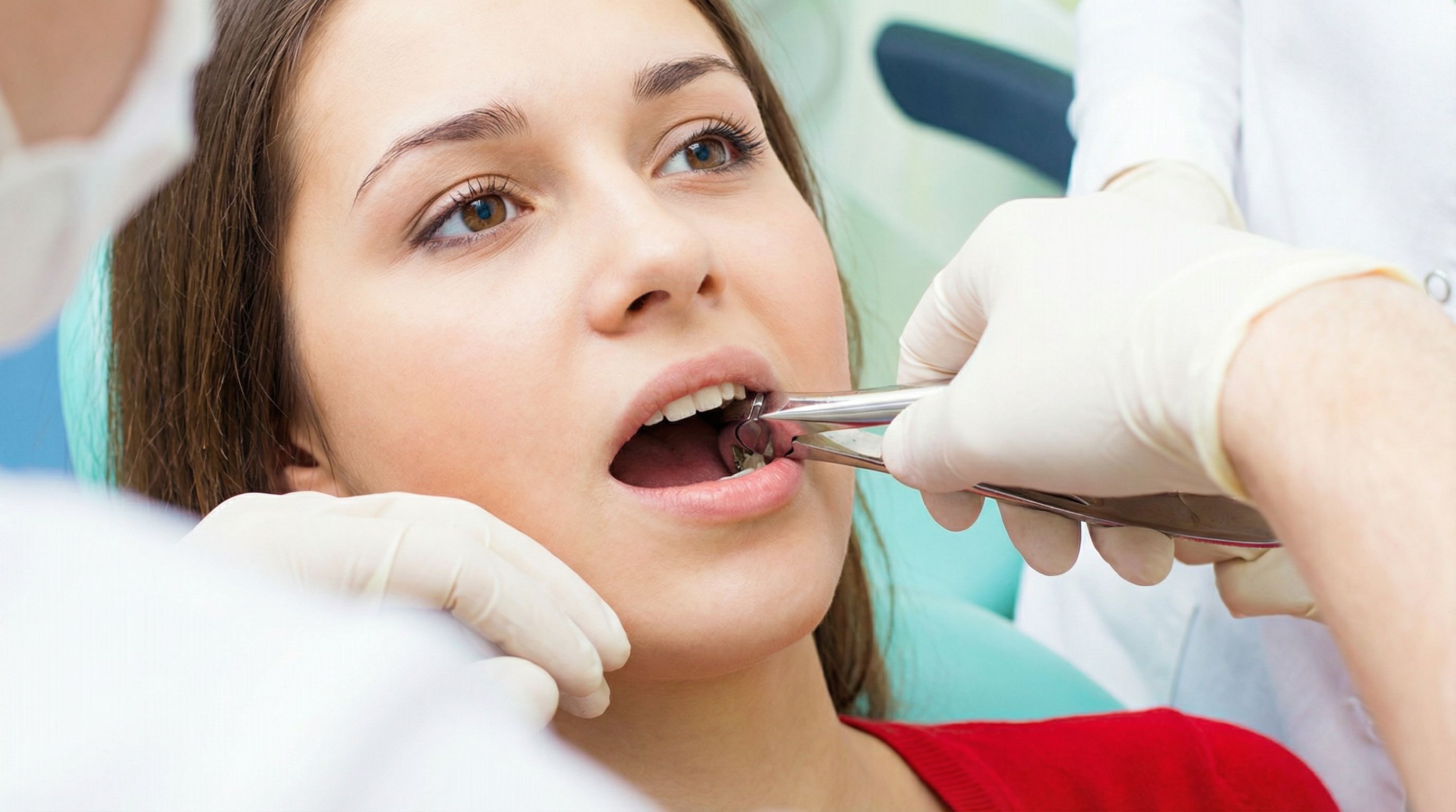 Extraction Dentaire : Tout Savoir sur l'Intervention et la Cicatrisation