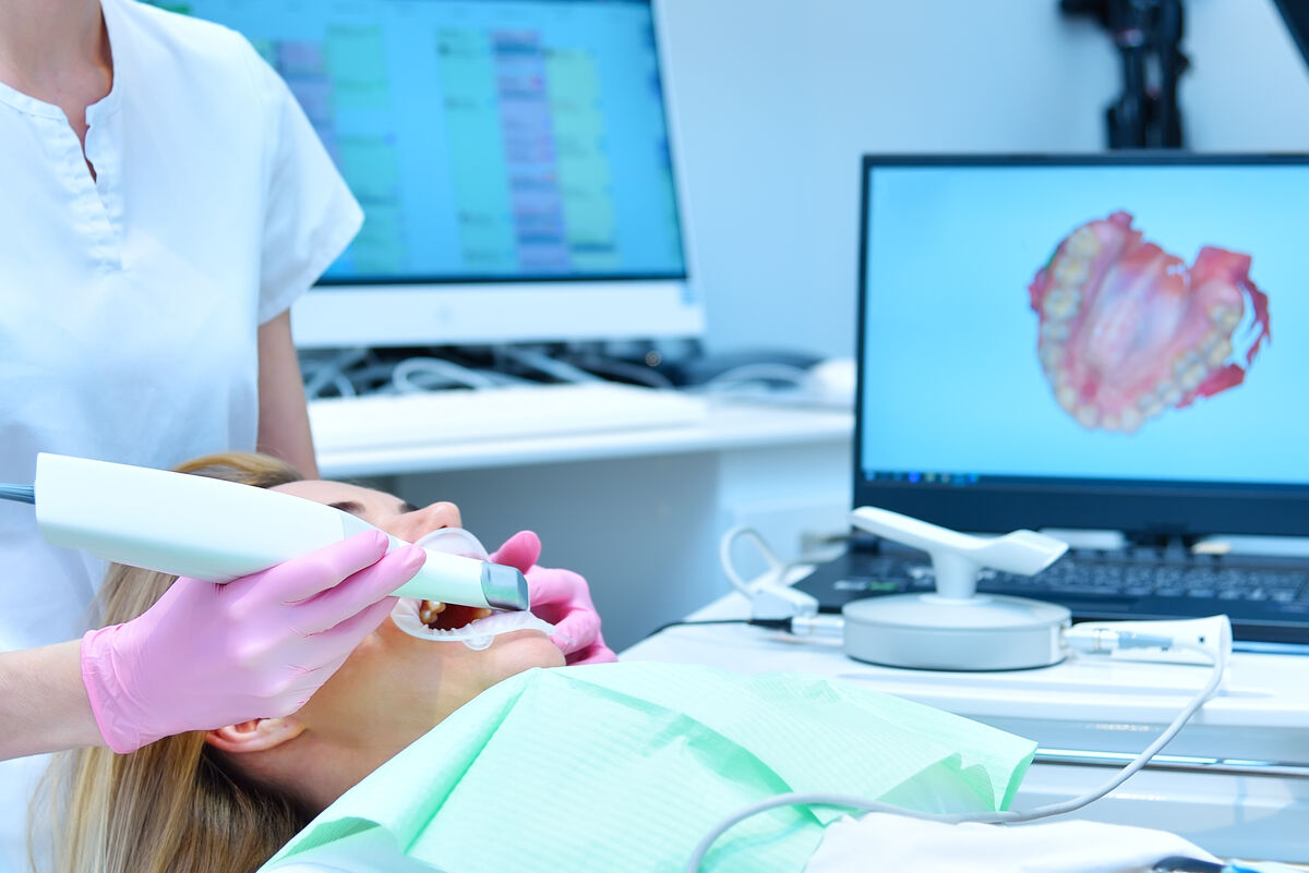 Patient recevant un scan 3D pour la planification de gouttières d'alignement.