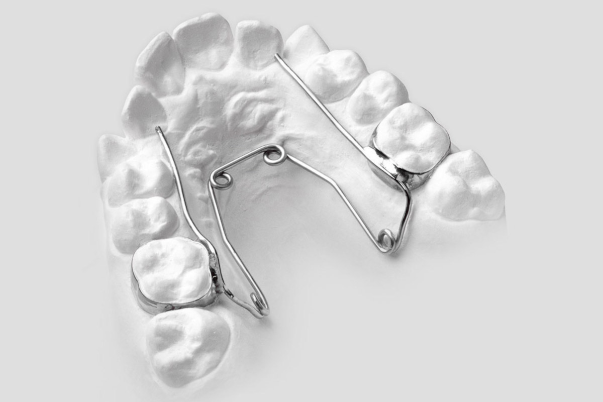 Appareil orthodontique Quad Hélix