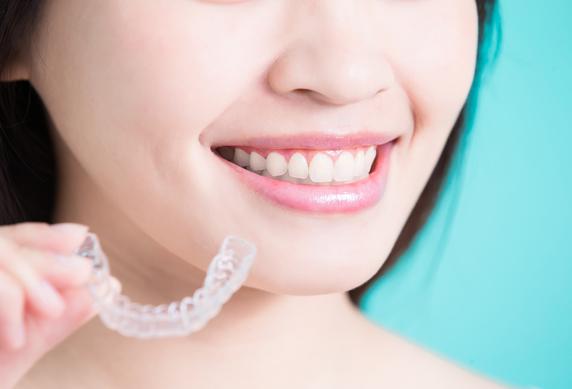 Invisalign, l’orthodontie moderne pour un sourire de star