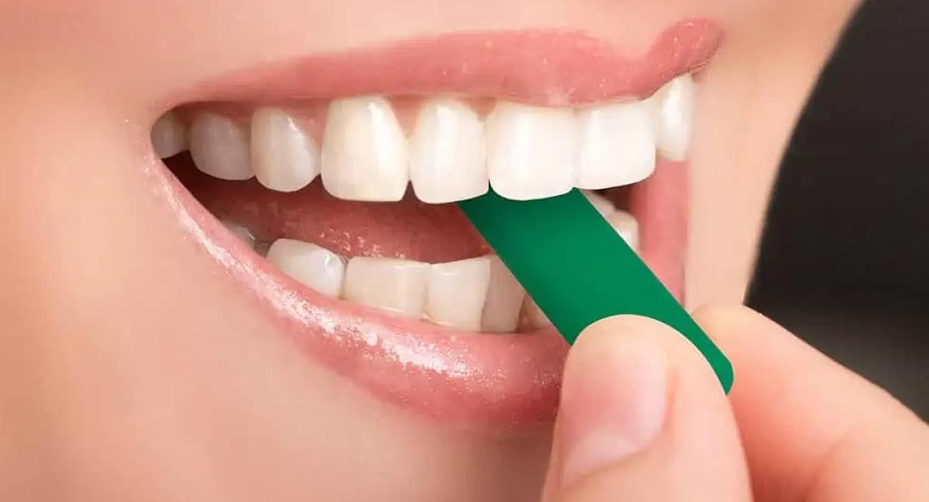 Chewies pour Invisalign